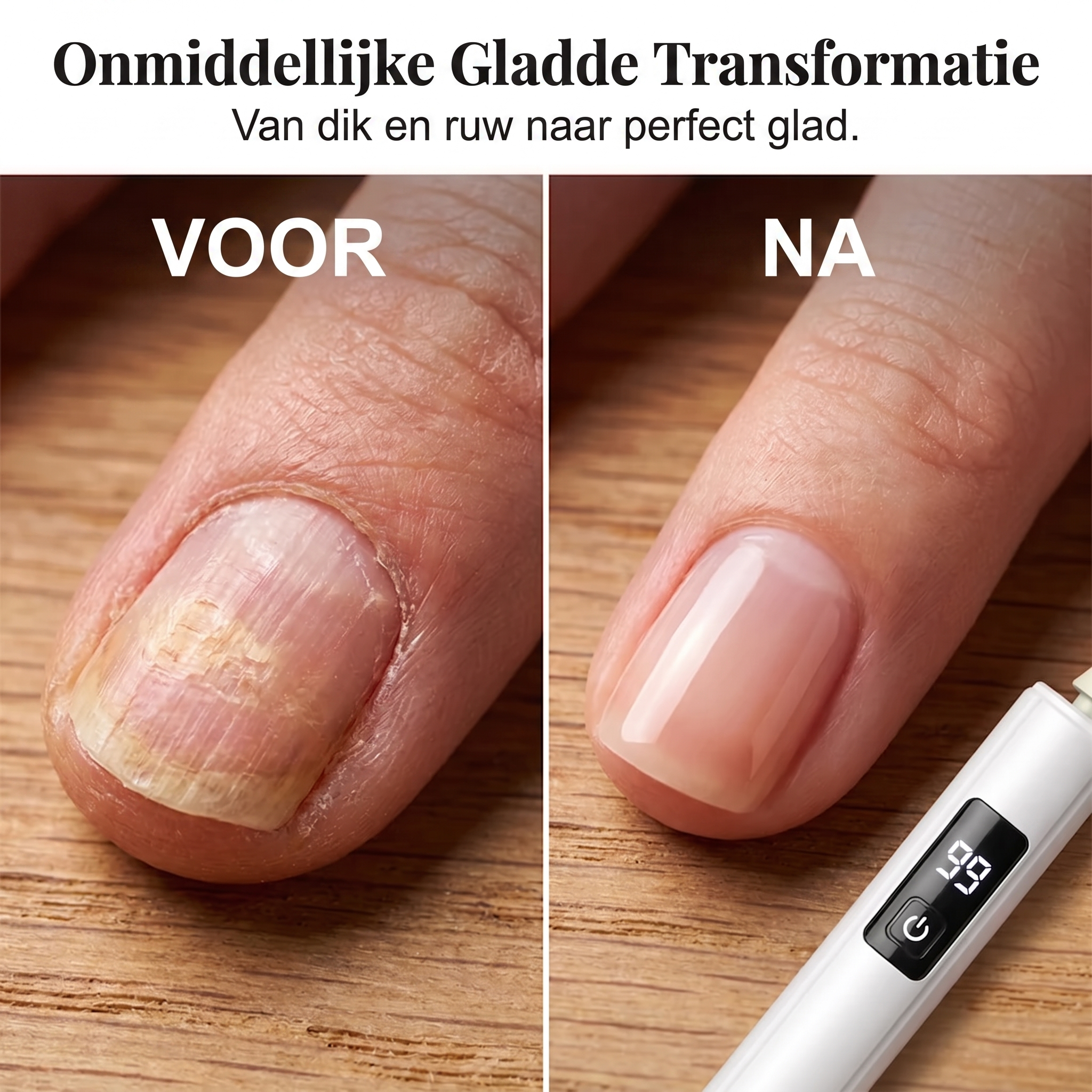 Calviro NailPro™ Elektrische Nagelfrees